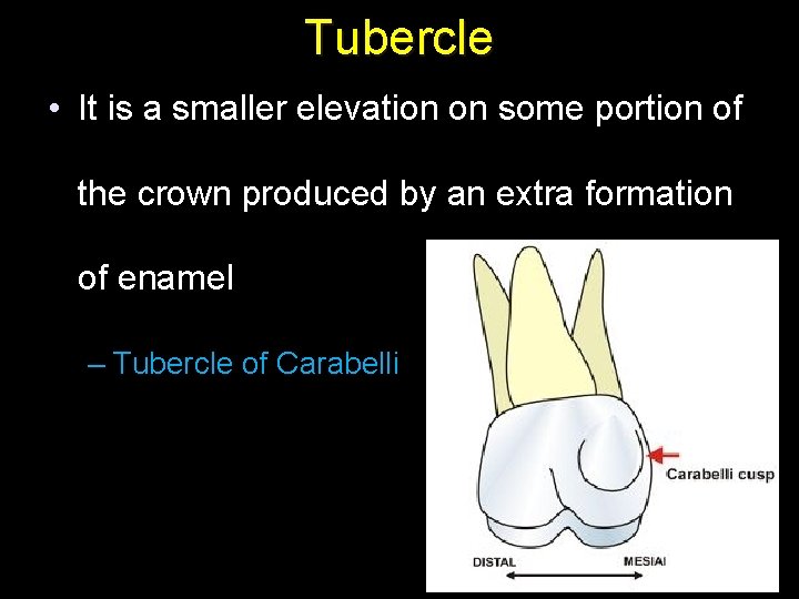 Tubercle • It is a smaller elevation on some portion of the crown produced