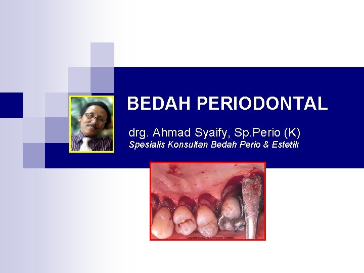 BEDAH PERIODONTAL drg. Ahmad Syaify, Sp. Perio (K) Spesialis Konsultan Bedah Perio & Estetik