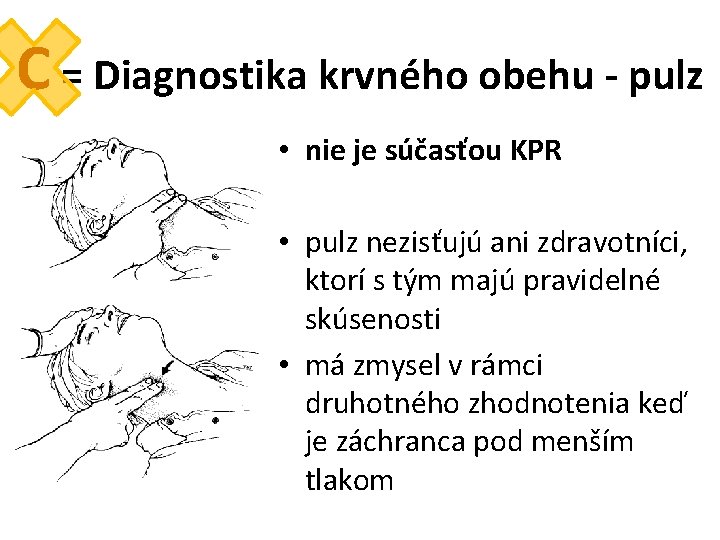 C = Diagnostika krvného obehu - pulz • nie je súčasťou KPR • pulz