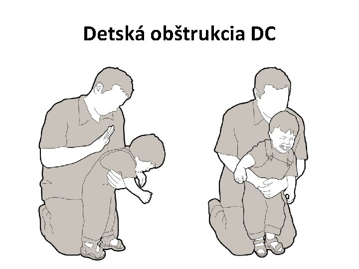 Detská obštrukcia DC 