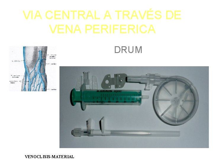 VIA CENTRAL A TRAVÉS DE VENA PERIFERICA DRUM VENOCLISIS-MATERIAL 