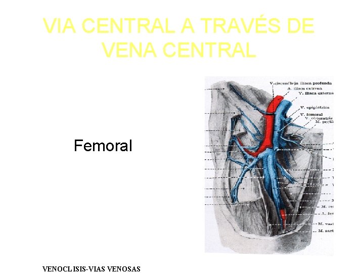 VIA CENTRAL A TRAVÉS DE VENA CENTRAL Femoral VENOCLISIS-VIAS VENOSAS 