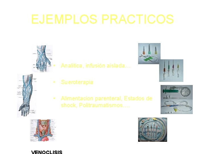 EJEMPLOS PRACTICOS • Analitica, infusión aislada… • Sueroterapia • Alimentacion parenteral, Estados de shock,