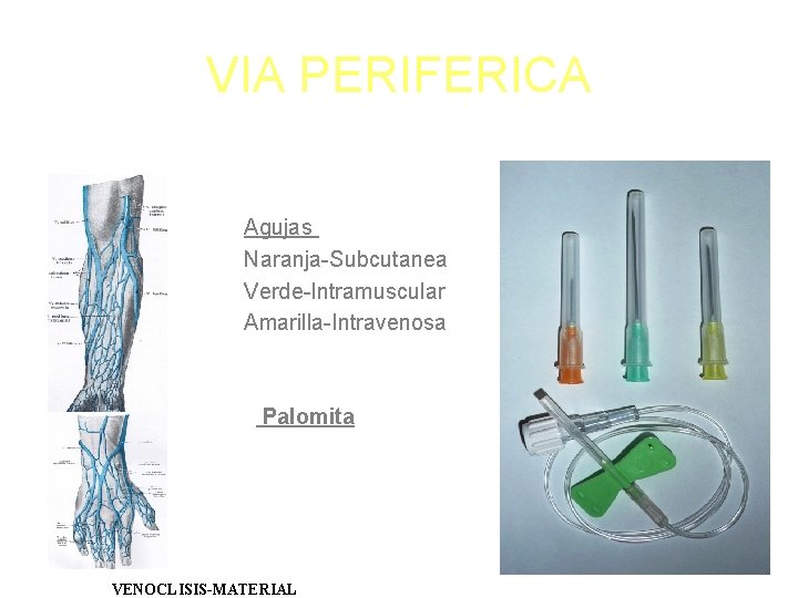 VIA PERIFERICA Agujas Naranja-Subcutanea Verde-Intramuscular Amarilla-Intravenosa Palomita VENOCLISIS-MATERIAL 