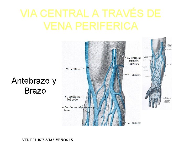 VIA CENTRAL A TRAVÉS DE VENA PERIFERICA Antebrazo y Brazo VENOCLISIS-VIAS VENOSAS 