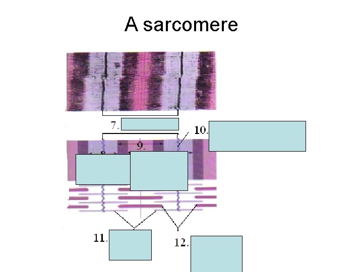 A sarcomere A sarcomere