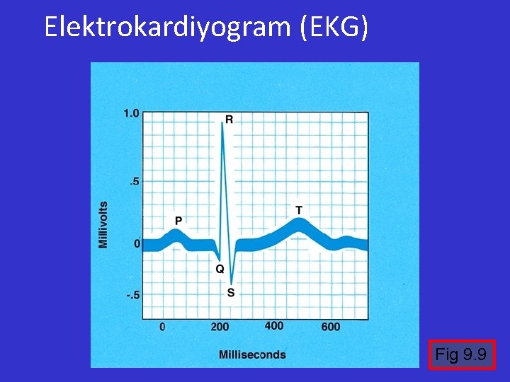 Elektrokardiyogram (EKG) Fig 9. 9 