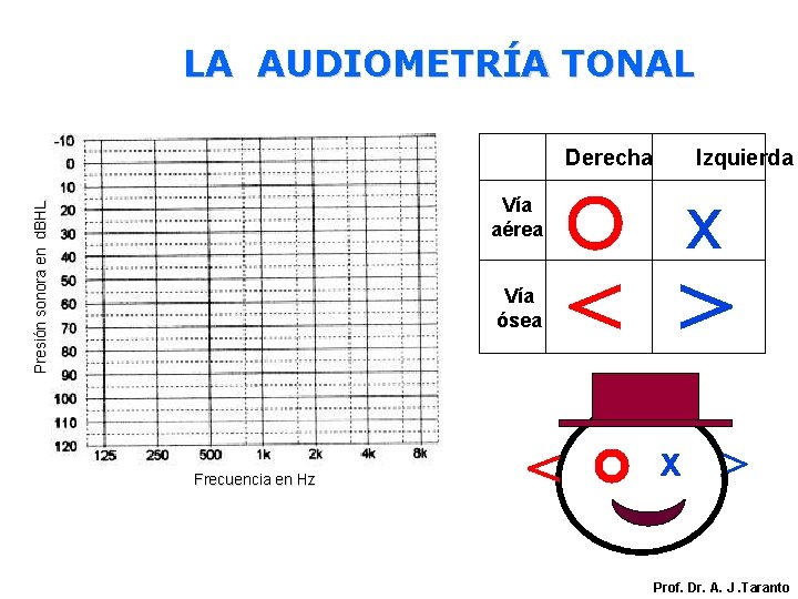 LA AUDIOMETRÍA TONAL Derecha Izquierda x Presión sonora en d. BHL Vía aérea Vía