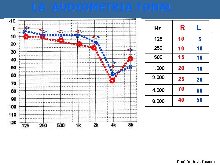 LA AUDIOMETRIA TONAL <> x <> x <> <> x x Hz R L