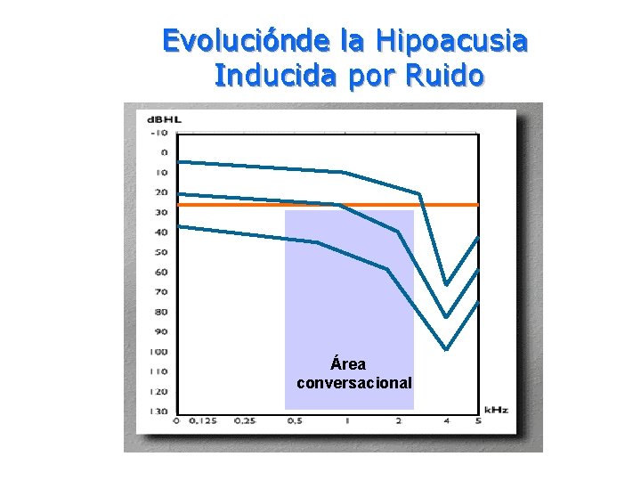 Prof. Dr. A. J. Taranto Evoluciónde la Hipoacusia Inducida por Ruido Área conversacional 