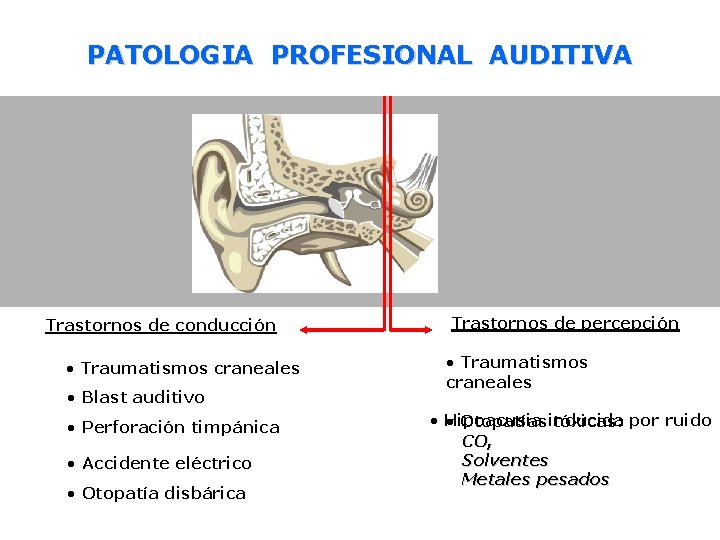 PATOLOGIA PROFESIONAL AUDITIVA Trastornos de conducción • Traumatismos craneales • Blast auditivo • Perforación