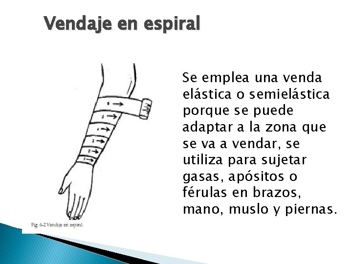 Vendaje en espiral Se emplea una venda elástica o semielástica porque se puede adaptar