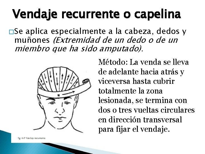 Vendaje recurrente o capelina � Se aplica especialmente a la cabeza, dedos y muñones