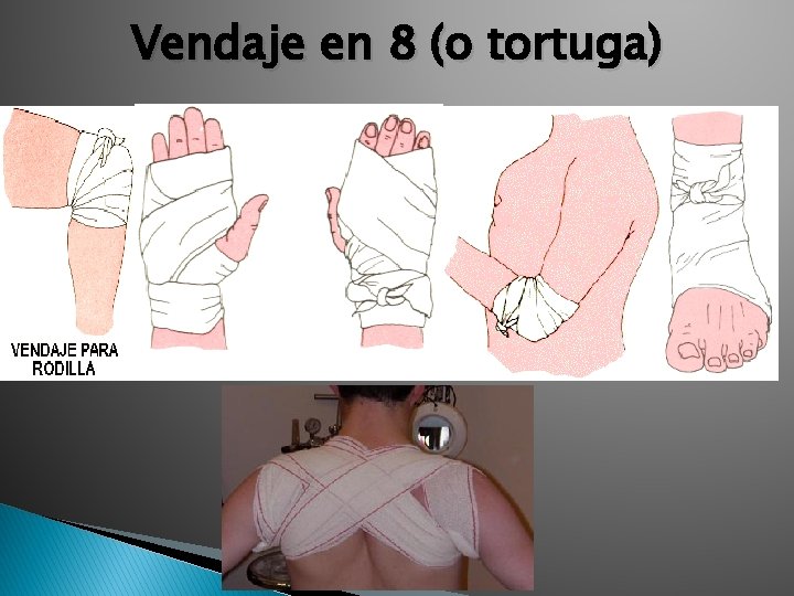 Vendaje en 8 (o tortuga) 