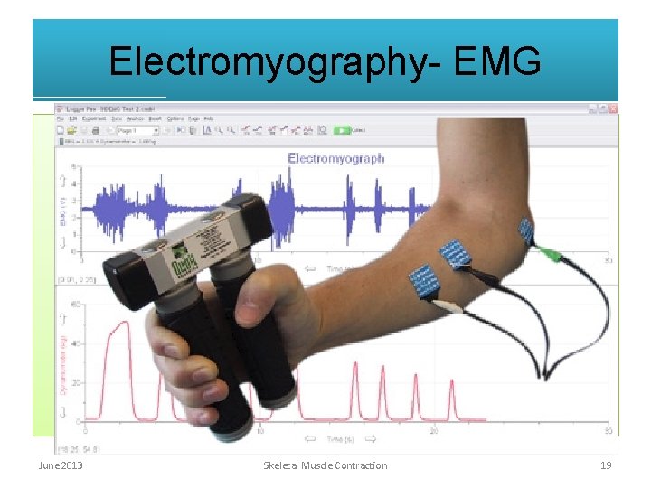 Electromyography- EMG June 2013 Skeletal Muscle Contraction 19 Electromyography- EMG June 2013 Skeletal Muscle Contraction 19