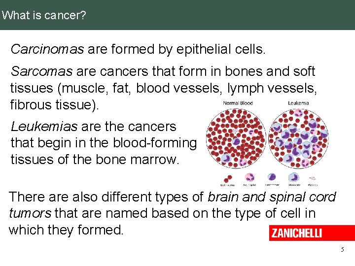 What is cancer? Carcinomas are formed by epithelial cells. Sarcomas are cancers that form