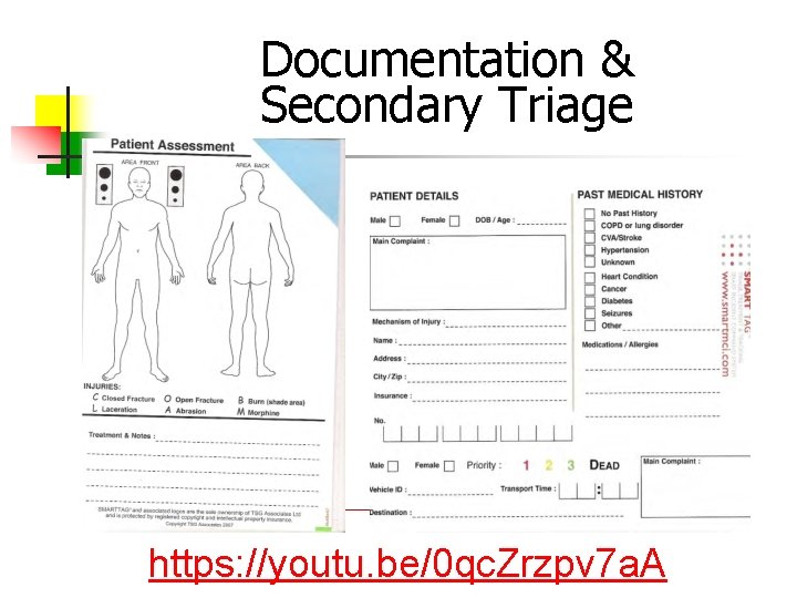 Documentation & Secondary Triage https: //youtu. be/0 qc. Zrzpv 7 a. A 