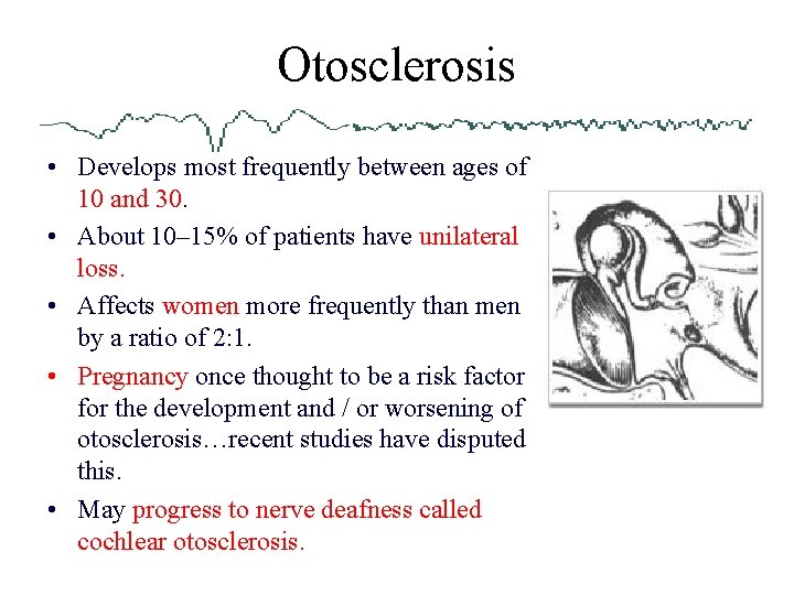 Otosclerosis • Develops most frequently between ages of 10 and 30. • About 10–
