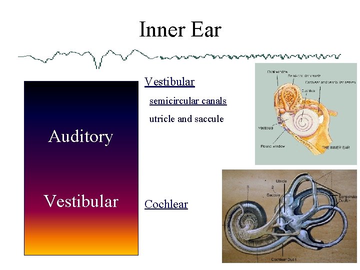 Inner Ear Vestibular semicircular canals utricle and saccule Auditory Vestibular Cochlear 