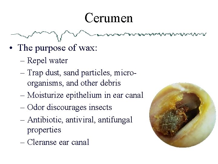 Cerumen • The purpose of wax: – Repel water – Trap dust, sand particles,