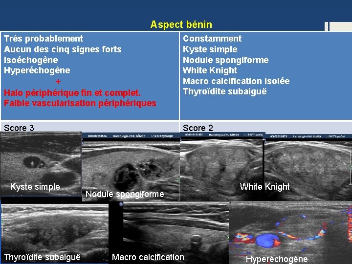 Aspect bénin Très probablement Aucun des cinq signes forts Isoéchogène Hyperéchogène + Aspect bénin