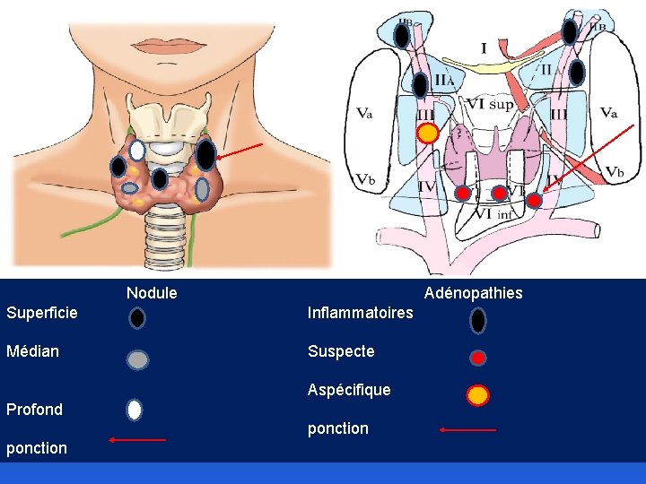 Nodule Superficie Médian Adénopathies Inflammatoires Suspecte Aspécifique Profond ponction 
