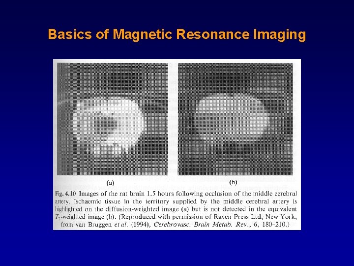 Basics of Magnetic Resonance Imaging 