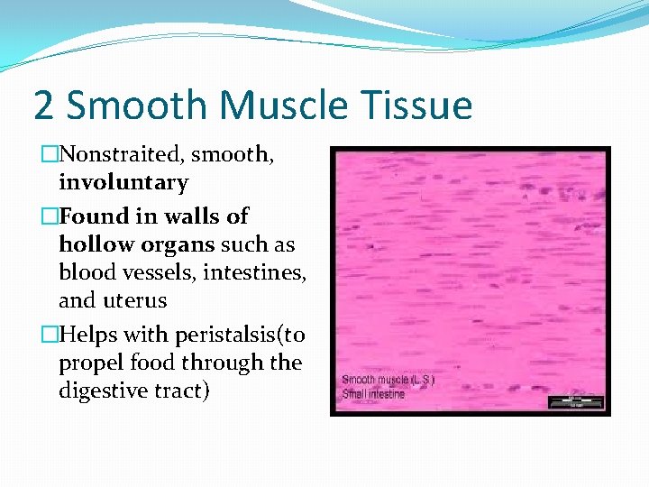 2 Smooth Muscle Tissue �Nonstraited, smooth, involuntary �Found in walls of hollow organs such