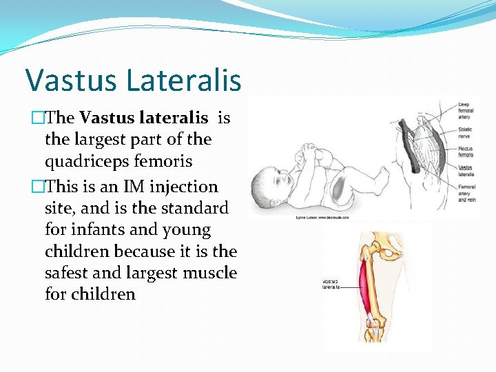 Vastus Lateralis �The Vastus lateralis is the largest part of the quadriceps femoris �This