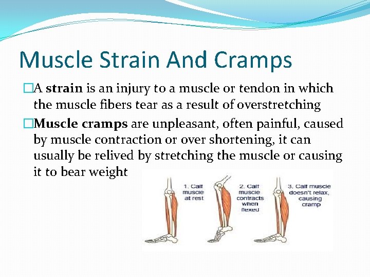 Muscle Strain And Cramps �A strain is an injury to a muscle or tendon