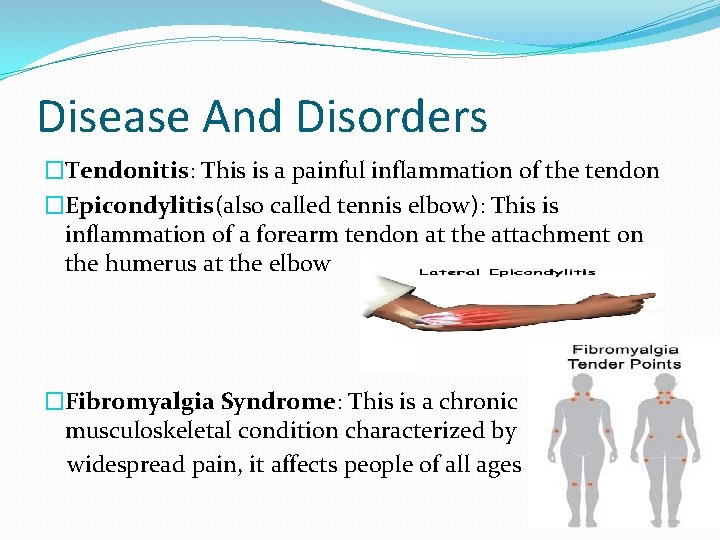 Disease And Disorders �Tendonitis: This is a painful inflammation of the tendon �Epicondylitis(also called