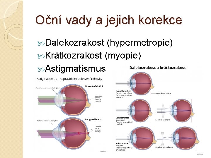 Oční vady a jejich korekce Dalekozrakost (hypermetropie) Krátkozrakost (myopie) Astigmatismus 