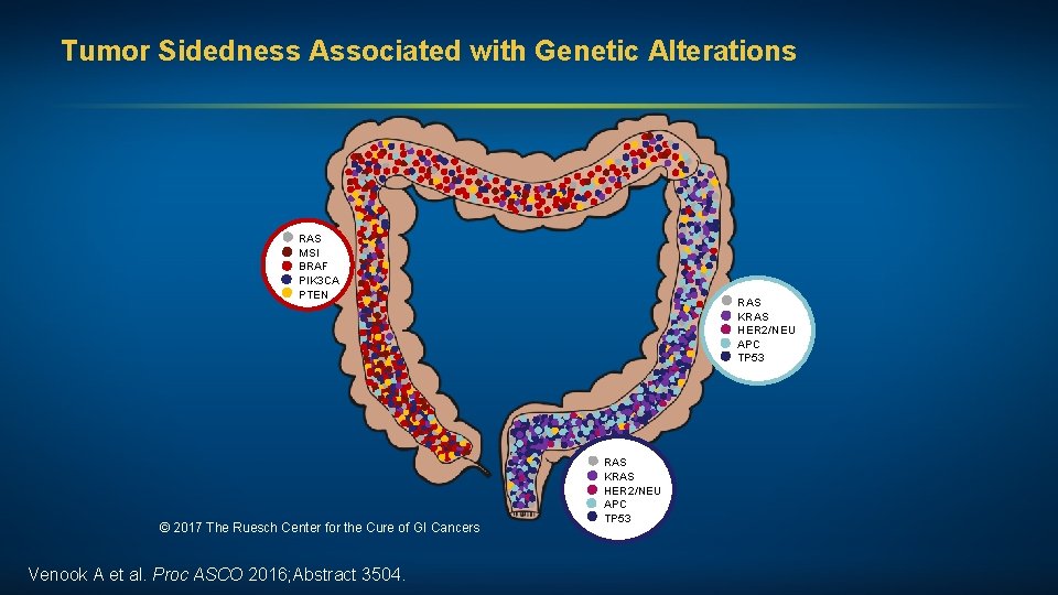 Tumor Sidedness Associated with Genetic Alterations RAS MSI BRAF PIK 3 CA PTEN ©