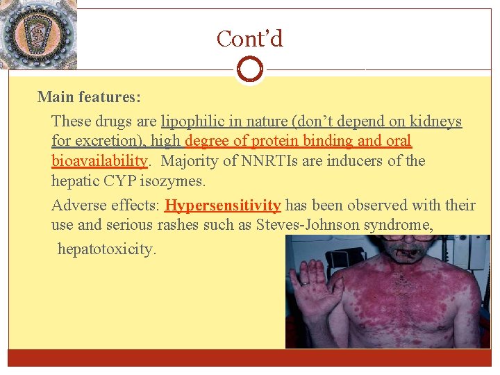 Cont’d Main features: These drugs are lipophilic in nature (don’t depend on kidneys for Cont’d Main features: These drugs are lipophilic in nature (don’t depend on kidneys for
