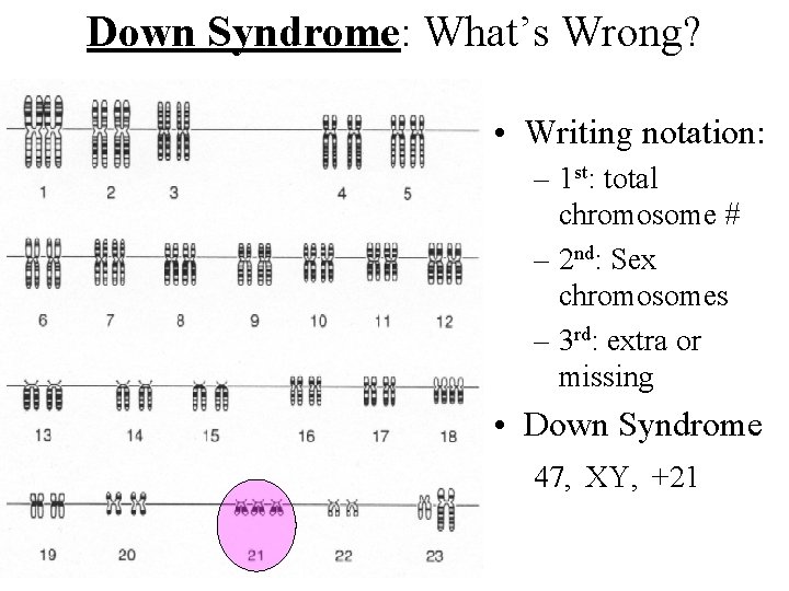 Down Syndrome: What’s Wrong? • Writing notation: – 1 st: total chromosome # –