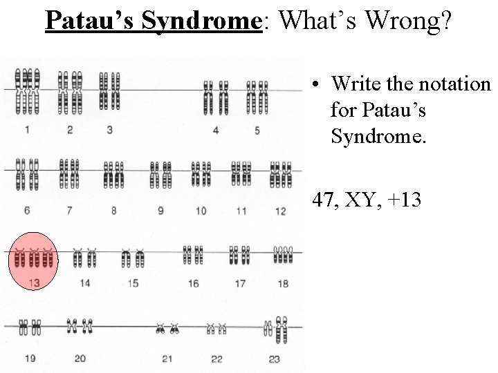 Patau’s Syndrome: What’s Wrong? • Write the notation for Patau’s Syndrome. 47, XY, +13