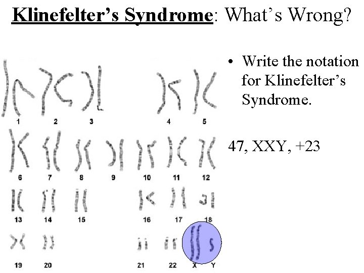 Klinefelter’s Syndrome: What’s Wrong? • Write the notation for Klinefelter’s Syndrome. 47, XXY, +23