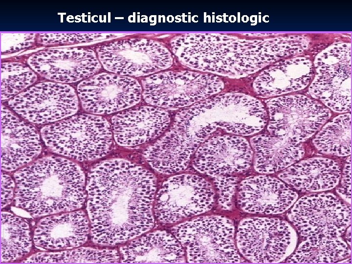 Testicul – diagnostic histologic 47 