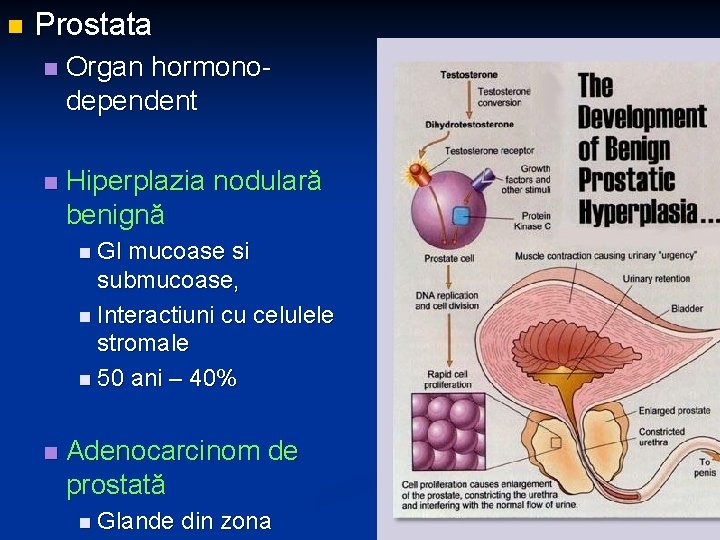 n Prostata n Organ hormonodependent n Hiperplazia nodulară benignă n Gl mucoase si submucoase,