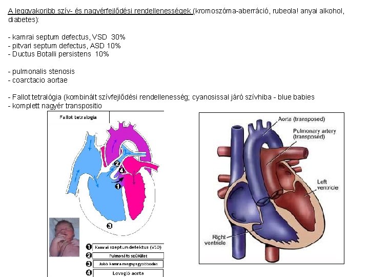 A leggyakoribb szív- és nagyérfejlődési rendellenességek (kromoszóma-aberráció, rubeola! anyai alkohol, diabetes): - kamrai septum