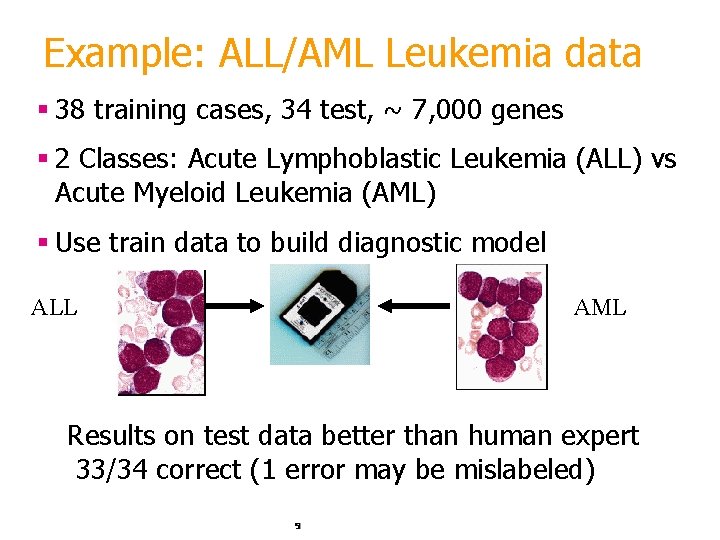 Example: ALL/AML Leukemia data § 38 training cases, 34 test, ~ 7, 000 genes