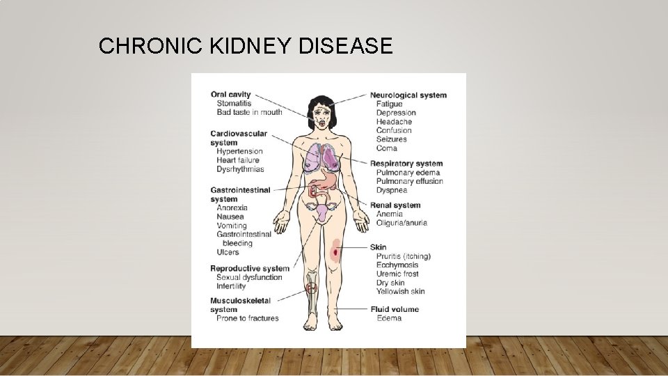 CHRONIC KIDNEY DISEASE 