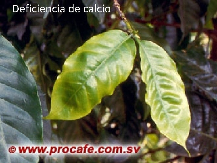 Deficiencia de calcio 