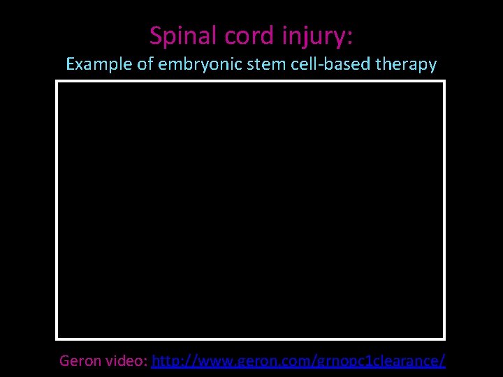 Spinal cord injury: Example of embryonic stem cell-based therapy Geron video: http: //www. geron.