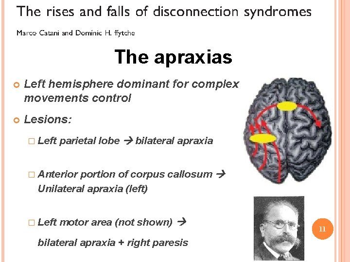 The apraxias Left hemisphere dominant for complex movements control Lesions: � Left parietal lobe