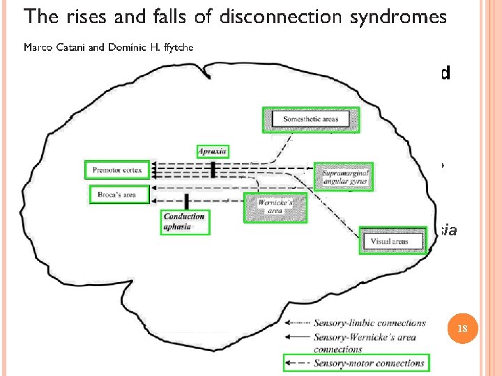 Disconnections between sensory areas and motor cortex Left hemisphere disconnections: motor cortex from posterior