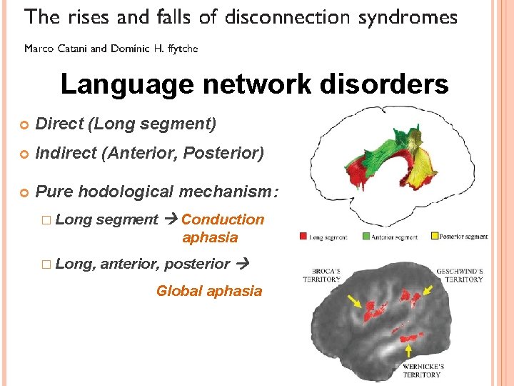 Language network disorders Direct (Long segment) Indirect (Anterior, Posterior) Pure hodological mechanism: segment Conduction