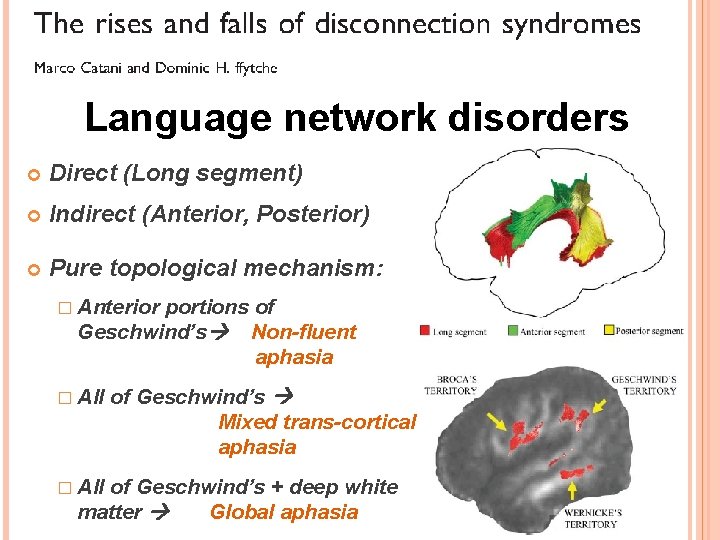 Language network disorders Direct (Long segment) Indirect (Anterior, Posterior) Pure topological mechanism: � Anterior