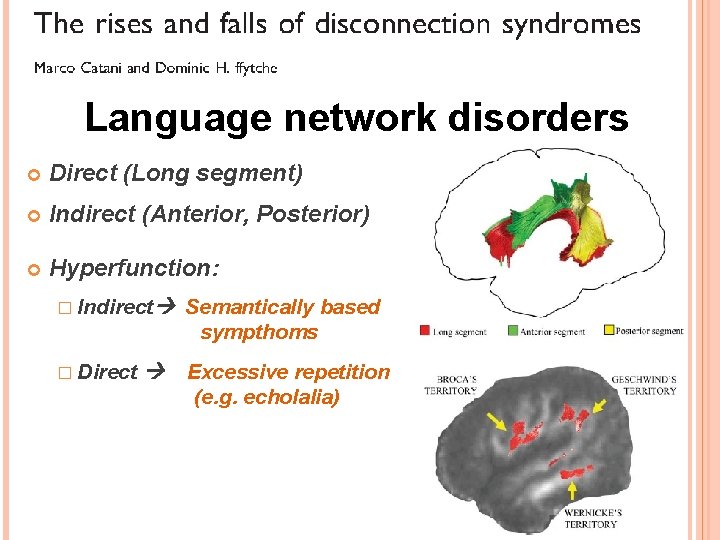 Language network disorders Direct (Long segment) Indirect (Anterior, Posterior) Hyperfunction: � Indirect � Direct