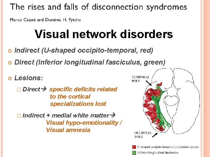 Visual network disorders Indirect (U-shaped occipito-temporal, red) Direct (Inferior longitudinal fasciculus, green) Lesions: �